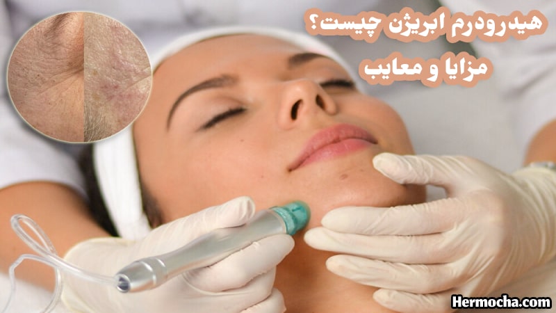 عکس هیدرودرم ابریژن چیست و چگونه انجام می شود؟