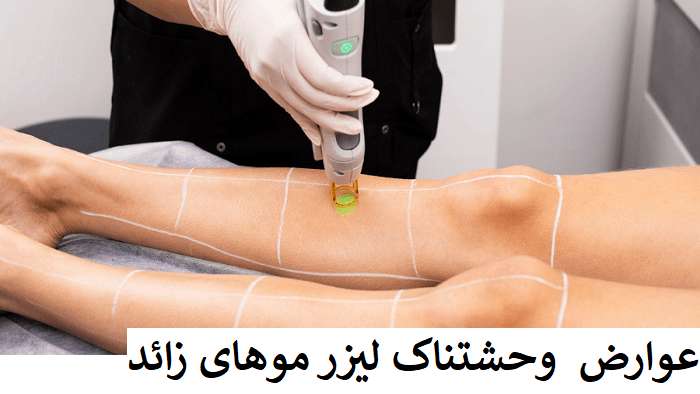 خطرات وحشتناک لیزر موهای زائد