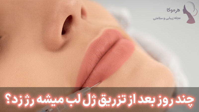 چند روز بعد از تزریق ژل لب میشه رژ زد؟